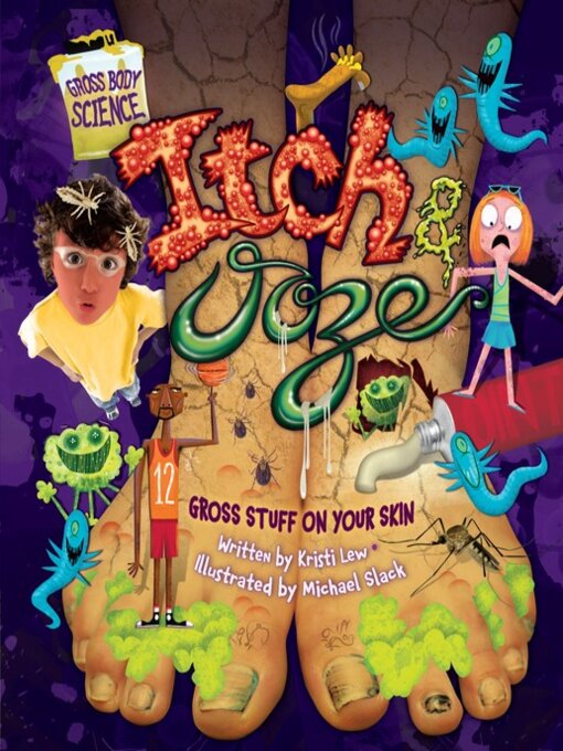 Title details for Itch & Ooze by Kristi Lew - Available